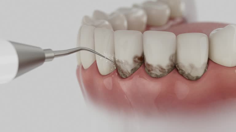 Trusted Wisdom Tooth Removal service in Orange Park, FL - Dentist Open Now